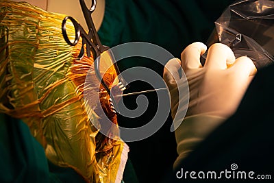 Neurosurgeon performing stereotactic biopsy in operating room Stock Photo