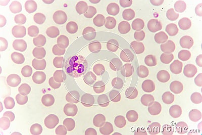 Neutrophil cell in blood smear Stock Photo