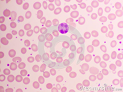 Neutrophil cell in blood smear Stock Photo