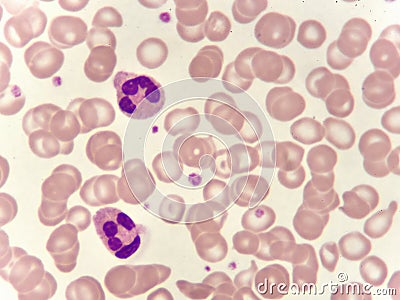 Neutrophil cell in blood smear Stock Photo