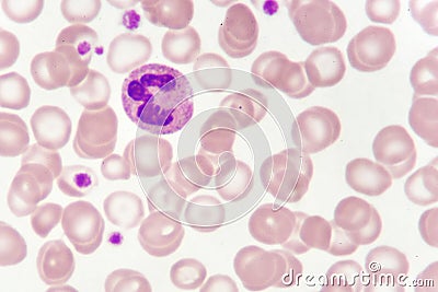 Neutrophil cell in blood smear Stock Photo