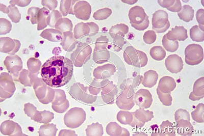 Neutrophil cell Stock Photo