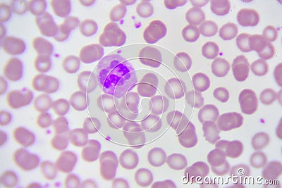 Neutrophil cell Stock Photo