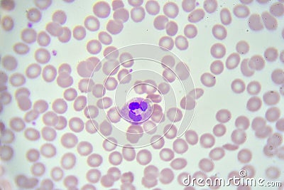Neutrophil cell white blood cell in blood smear Stock Photo