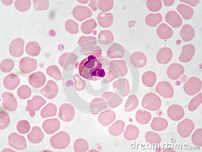 Neutrophil cells Stock Photo