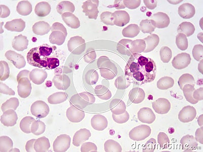 Neutrophil cells Stock Photo