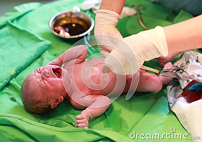 Newborn baby after birth Stock Photo
