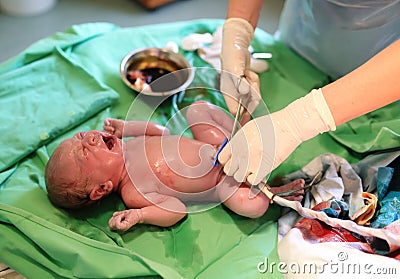 Newborn baby after birth in hospital Stock Photo