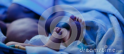 newborn baby lying under blue lamp because of bilirubin, phototherapy, he has jaundice Stock Photo