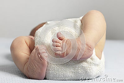Newborn with bilateral club foot Stock Photo