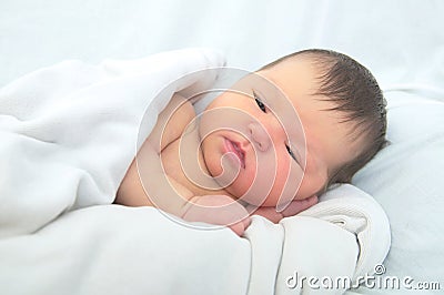 Newborn jaundice, baby portrait Stock Photo