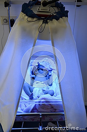 Newborn with jaundice under ultraviolet a light. Stock Photo