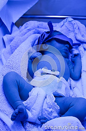 Newborn with jaundice under ultraviolet a light. Stock Photo