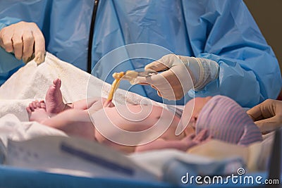 Newborn male baby ready for umbilical cord to be cut Stock Photo