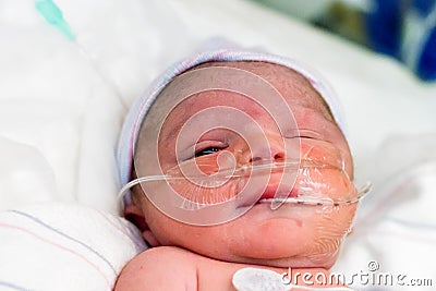 Newborn On Oxygen Stock Photo