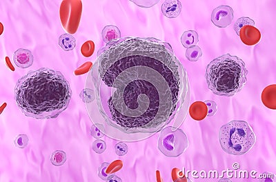 Non-hodgkin lymphoma NHL cells in the blood flow - closeup view 3d illustration Stock Photo