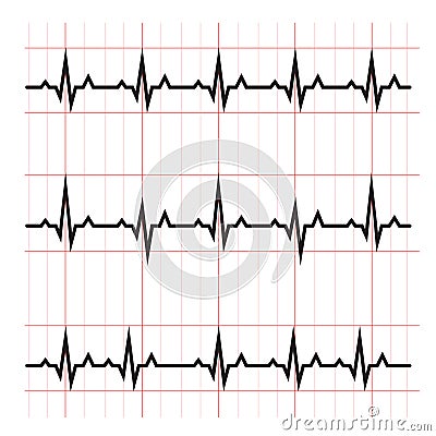Normal and abnormal ECG medical science Vector Illustration