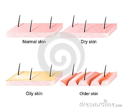 Normal, dry, oily, younger and older skin. sectional view Vector Illustration