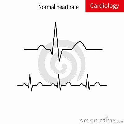 Normal ECG complex and normal sinus rhythm. Cartoon Illustration