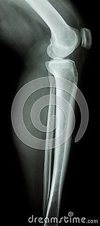 Normal human's knee&leg Stock Photo