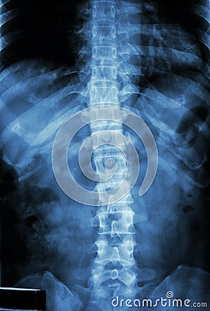 Normal human's thoracic-lumbar spine Stock Photo