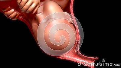 Normal labor and vaginal birth Stock Photo