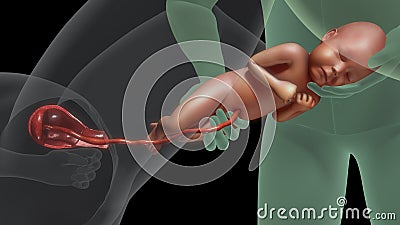 Normal labor and vaginal birth Stock Photo