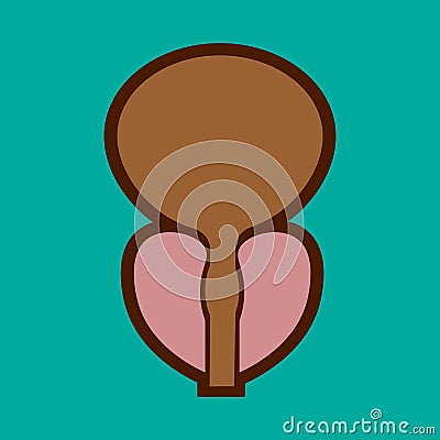 Normal prostate and acute prostatitis. Medical illustration Cartoon Illustration