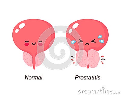 Normal prostate and benign prostatic hyperplasia Vector Illustration