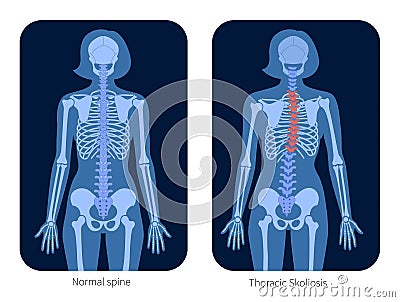 Spine X ray Vector Illustration