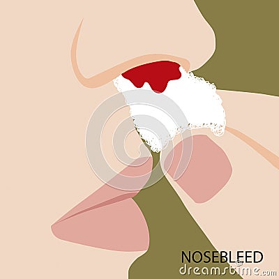 Nosebleeds use a tissue to stop the blood, Illustration in flat design isolated Stock Photo