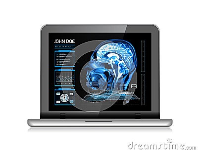 Notebook monitor with medical MRI and other real-time analyzes. Medicine of the future. Vector illustration on white Vector Illustration