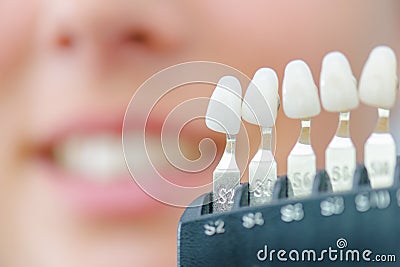 Numbered individual false teeth for colour match Stock Photo
