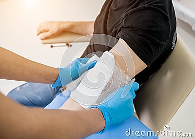 Nurse dressing wound for patient`s hand with burn injury Stock Photo