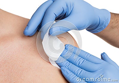 Nurse hand patching mole removal surgery incision Stock Photo