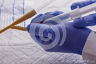 Nurse inflates urinary catheter bulb with leg drainage bag on sterile field. Stock Photo