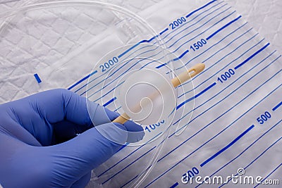 Nurse inflates urinary catheter bulb with leg drainage bag on sterile field. Stock Photo