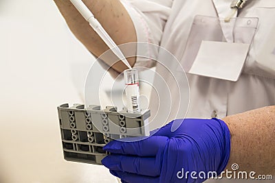 A nurse in medical uniform in blue latex gloves holds test tubes. laboratory assistant holds test tube and pipette in hand Stock Photo