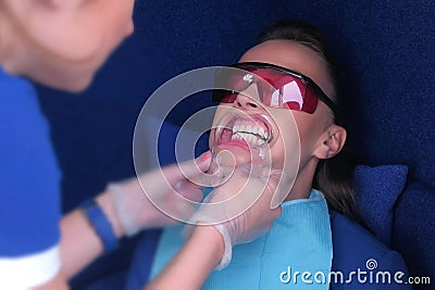 Nurse Preparing woman to LED whitening teeth installs dental retractor. Stock Photo