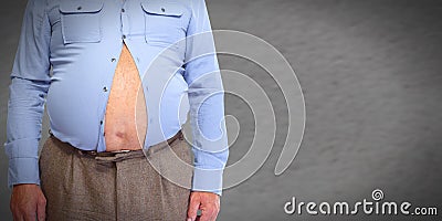 Obese man abdomen. Stock Photo