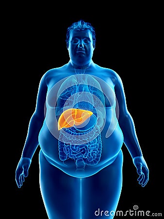 An obese mans liver Cartoon Illustration