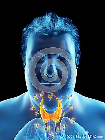 An obese mans thyroid gland being attacked by antibodies Cartoon Illustration