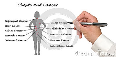 Obesity and Cancer Stock Photo