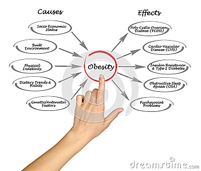 Obesity: causes and effects Stock Photo