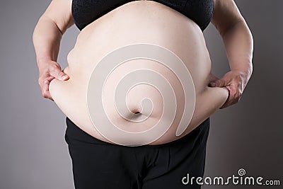 Obesity female body, fat woman belly close up Stock Photo