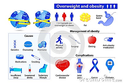 Obesity and overweight infographic. Vector Illustration