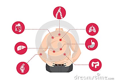 Obesity related diseases Vector Illustration