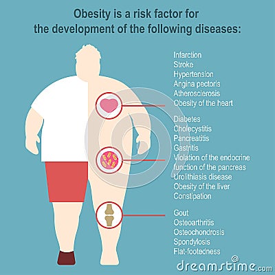 Obesity Vector illustration Vector Illustration