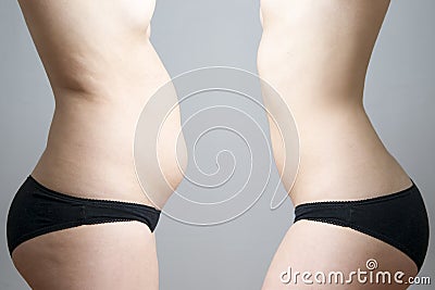 Obesity before after Stock Photo