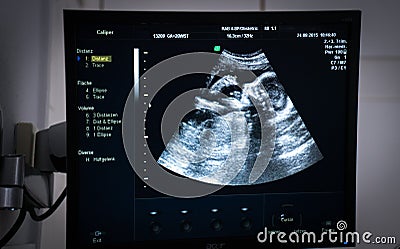 Obstetric Ultrasound of fetus Editorial Stock Photo